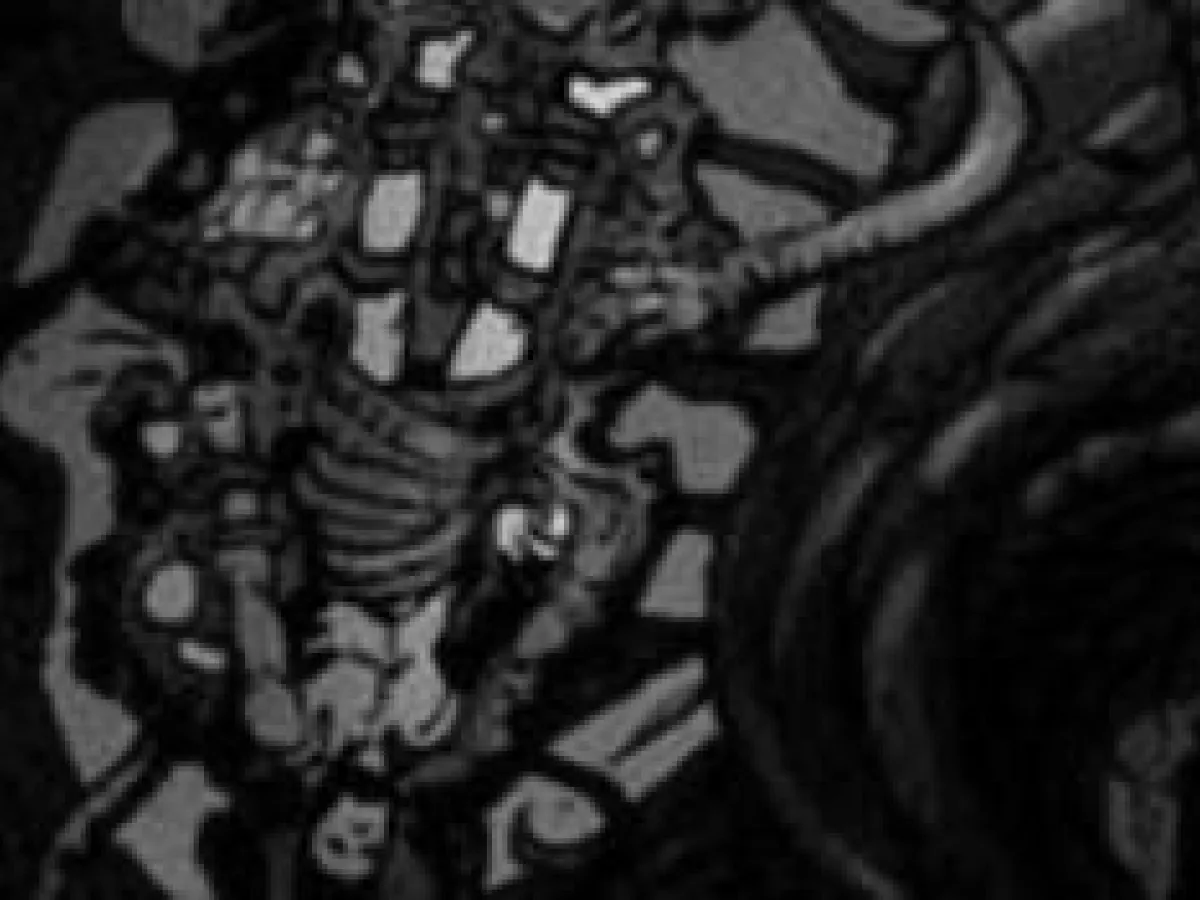 Etreinte de la douleur