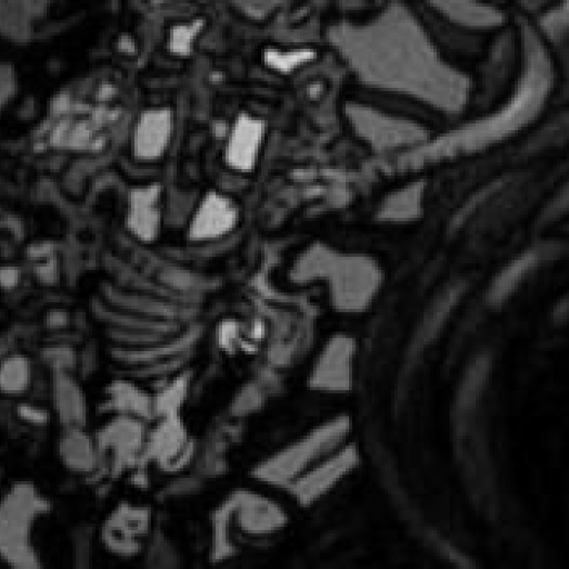 Etreinte de la douleur